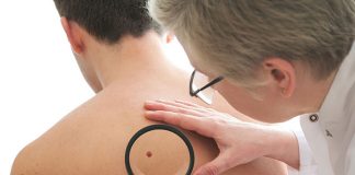 Nowotwór skóry. Objawy, przyczyny, metody leczenia