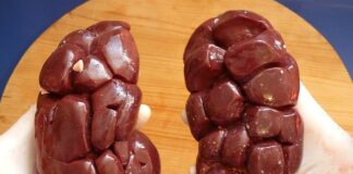 Jak uratować nerki?