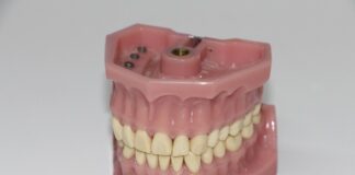 Jak najlepiej uzupełnić braki w uzębieniu?